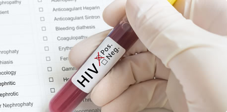 Testování na HIV a žloutenky
